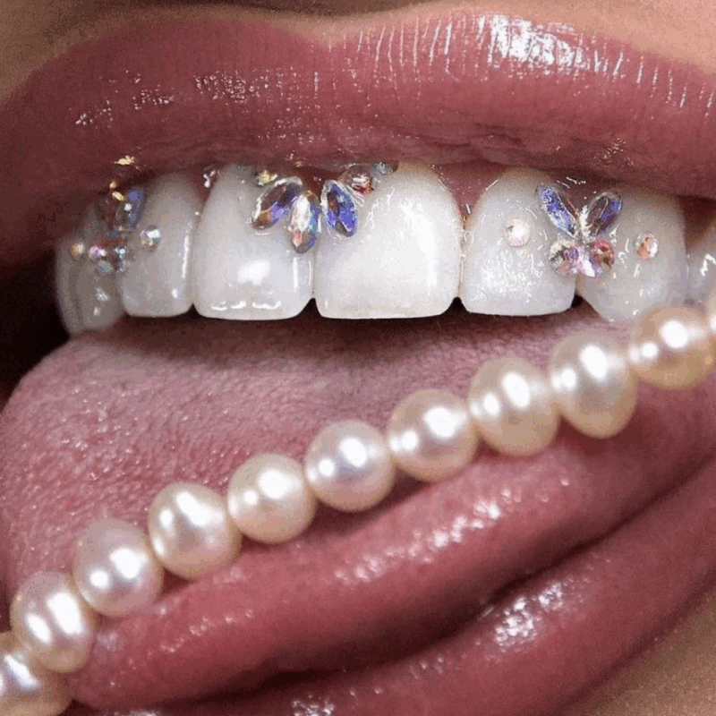 Strass dentaire formation Julie lecluze perpignan